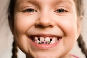 young girl with metal braces