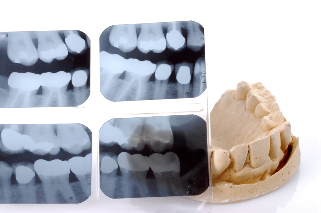 Dental X-Ray Technology