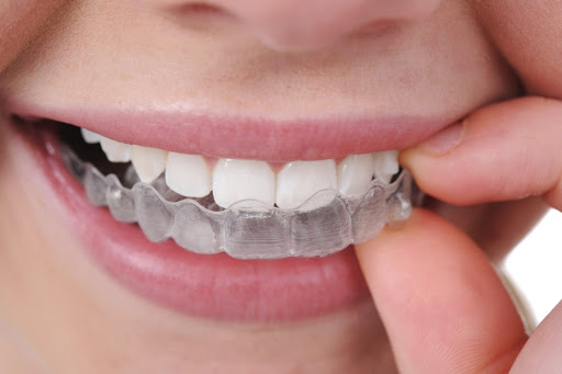 Staying Safe and Healthy with Invisalign During COVID-19