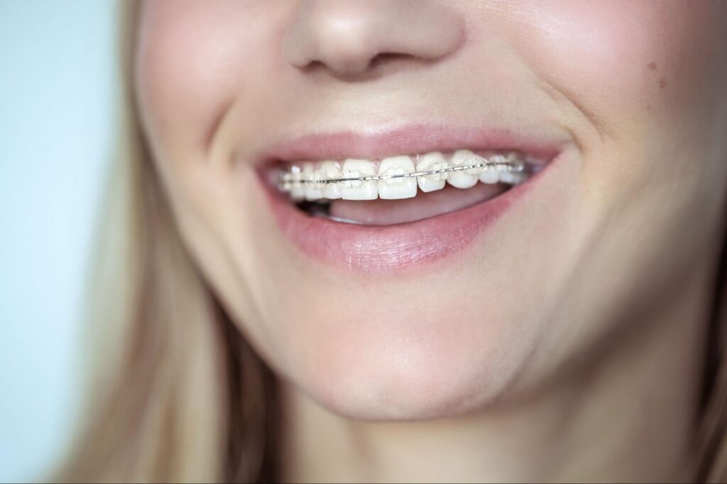 Guide to Orthodontics While Sick