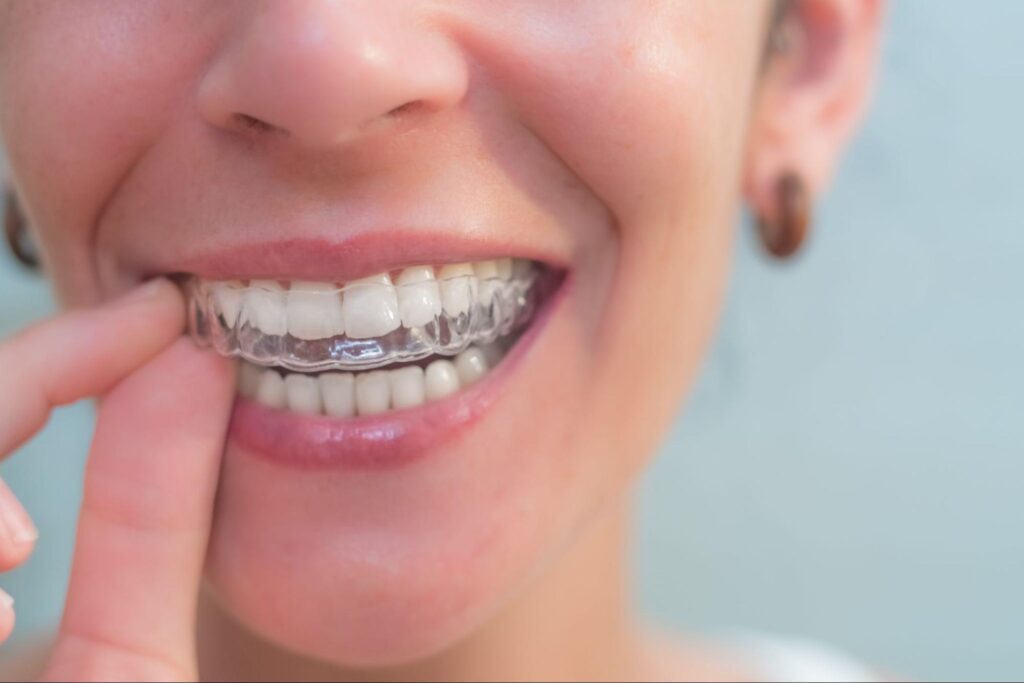 How To Get The Most Out Of Invisalign Treatment